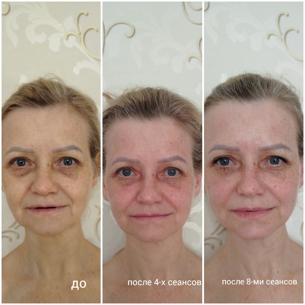 Курс до 4 и 8 сеансов